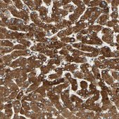 Anti-CYB5B antibody produced in rabbit Prestige Antibodies® Powered by Atlas Antibodies, affinity isolated antibody, buffered aqueous glycerol solution