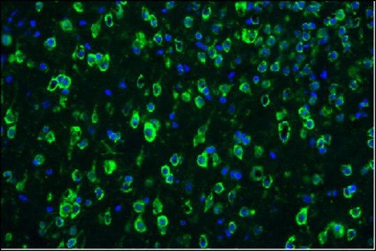 Anti-Tau-1 Antibody, clone PC1C6, Alexa Fluor&#8482; 488 Conjugate clone PC1C6, from mouse, ALEXA FLUOR&#8482; 488