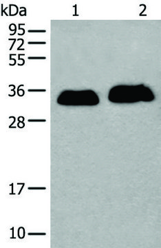 Anti-ATP1B2 affinity isolated antibody