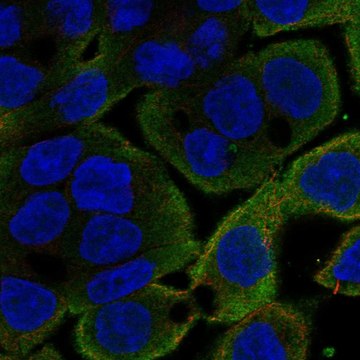 Anti-Cfl1 Antibody Produced In Rabbit Prestige Antibodies&#174; Powered by Atlas Antibodies, affinity isolated antibody, buffered aqueous glycerol solution