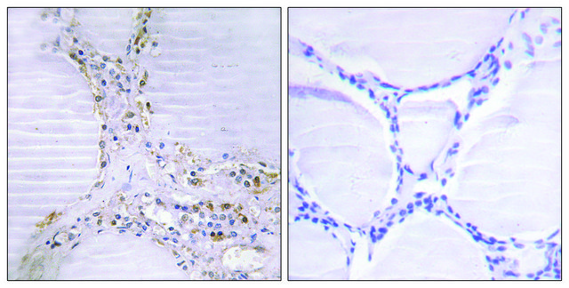 Anti-BMX, N-Terminal antibody produced in rabbit affinity isolated antibody