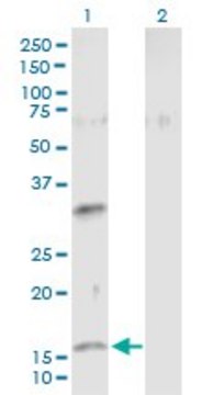 Anti-NMU antibody produced in mouse purified immunoglobulin, buffered aqueous solution