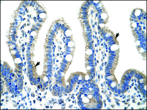 Anti-FBL antibody produced in rabbit IgG fraction of antiserum