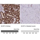 Anti-GLYAT antibody produced in rabbit Prestige Antibodies® Powered by Atlas Antibodies, affinity isolated antibody