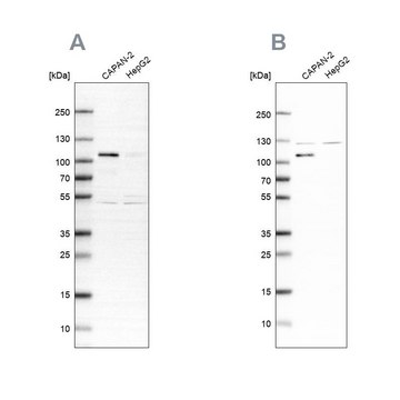 抗 SP1 兔抗 Ab1, Prestige Antibodies&#174; Powered by Atlas Antibodies, affinity isolated antibody, buffered aqueous glycerol solution