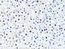 Anti- Histone H2B antibody produced in rabbit