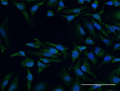 Anti-SMN2 antibody produced in mouse purified immunoglobulin, buffered aqueous solution