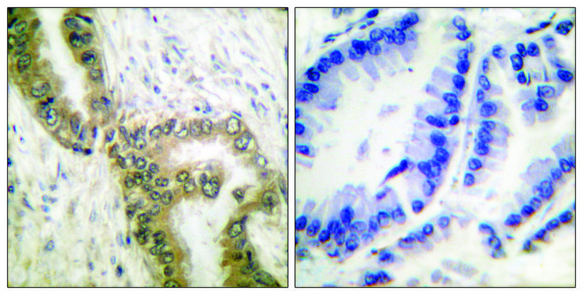 Anti-p53 (Acetyl-Lys386), C-Terminal antibody produced in rabbit affinity isolated antibody