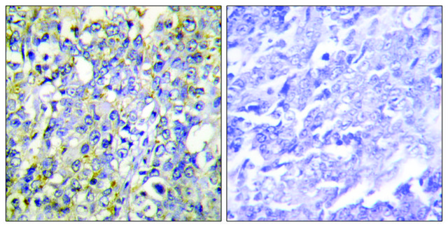 Anti-IGFBP-3 antibody produced in rabbit affinity isolated antibody