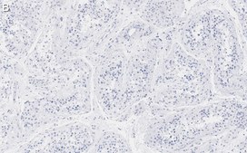 Anti-METTL7A Antibody, clone 1O8 ZooMAb® Rabbit Monoclonal recombinant, expressed in HEK 293 cells