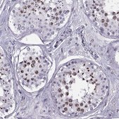 Anti-H1FOO antibody produced in rabbit Prestige Antibodies® Powered by Atlas Antibodies, affinity isolated antibody, buffered aqueous glycerol solution