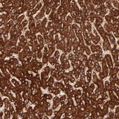 Anti-DLST antibody produced in rabbit Prestige Antibodies® Powered by Atlas Antibodies, affinity isolated antibody, buffered aqueous glycerol solution