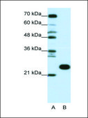 Anti-RPL13 antibody produced in rabbit affinity isolated antibody