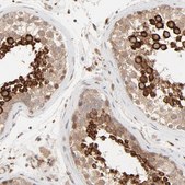 Anti-RAB5C antibody produced in rabbit Prestige Antibodies® Powered by Atlas Antibodies, affinity isolated antibody, buffered aqueous glycerol solution