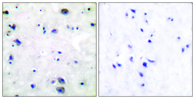 Anti-Opioid Receptor antibody produced in rabbit affinity isolated antibody