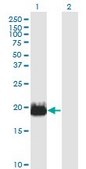 Monoclonal Anti-IFT20 antibody produced in mouse clone 3F3, purified immunoglobulin, buffered aqueous solution
