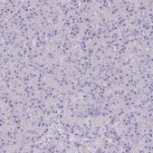 Anti-UBA6 antibody produced in rabbit Prestige Antibodies® Powered by Atlas Antibodies, affinity isolated antibody, buffered aqueous glycerol solution