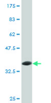 Monoclonal Anti-UBE3A antibody produced in mouse clone 3E5, purified immunoglobulin, buffered aqueous solution