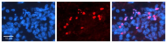 Anti-RORA antibody produced in rabbit affinity isolated antibody