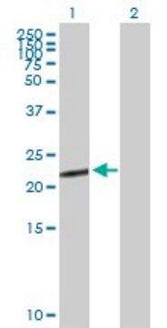 Anti-CGB5 antibody produced in mouse purified immunoglobulin, buffered aqueous solution