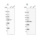 Anti-ATP5A1 antibody produced in rabbit Prestige Antibodies® Powered by Atlas Antibodies, affinity isolated antibody, buffered aqueous glycerol solution