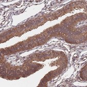 Anti-UNC45A antibody produced in rabbit Prestige Antibodies® Powered by Atlas Antibodies, affinity isolated antibody, buffered aqueous glycerol solution