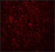 Anti-PLEKHM2 antibody produced in rabbit affinity isolated antibody, buffered aqueous solution