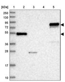 Anti-ABLIM1 antibody produced in rabbit Prestige Antibodies® Powered by Atlas Antibodies, affinity isolated antibody, buffered aqueous glycerol solution