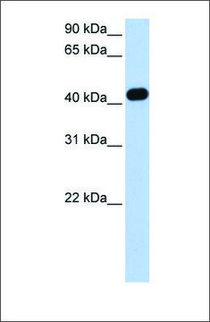 抗 CKMT2 兔抗 affinity isolated antibody