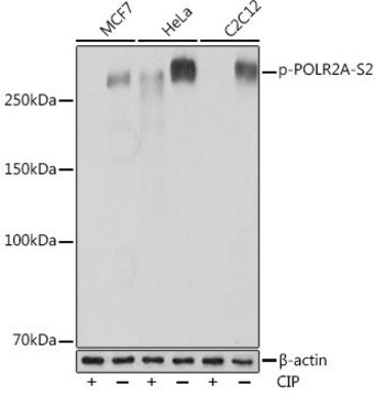 Anti-Phospho-POLR2A-S2 antibody produced in rabbit