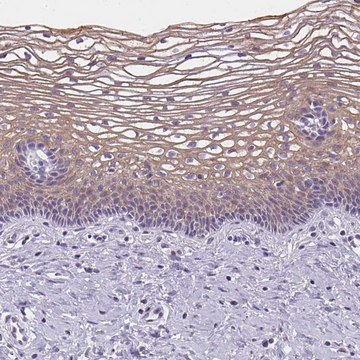 Anti-GSDMC antibody produced in rabbit Prestige Antibodies&#174; Powered by Atlas Antibodies, affinity isolated antibody, buffered aqueous glycerol solution, Ab3