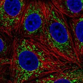 Anti-L2HGDH antibody produced in rabbit Prestige Antibodies® Powered by Atlas Antibodies, affinity isolated antibody, buffered aqueous glycerol solution