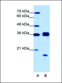 Anti-HNRPH3 antibody produced in rabbit IgG fraction of antiserum