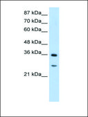 Anti-GIPC2 antibody produced in rabbit IgG fraction of antiserum