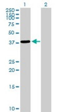 Anti-EPM2A antibody produced in rabbit purified immunoglobulin, buffered aqueous solution