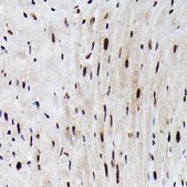Anti-Phospho-FOXO3A-S425 antibody produced in rabbit