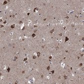 Anti-SLC2A13 antibody produced in rabbit Prestige Antibodies® Powered by Atlas Antibodies, affinity isolated antibody, buffered aqueous glycerol solution