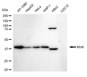 KD-Validated Anti Mevalonate Kinase Antibody, clone 24GB115, Rabbit Monoclonal clone 24GB115, recombinant rabbit monoclonal, expressed in HEK293 cells