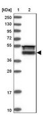 Anti-FAM53B antibody produced in rabbit Prestige Antibodies® Powered by Atlas Antibodies, affinity isolated antibody, buffered aqueous glycerol solution