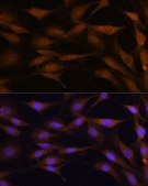 Anti-TFAP4 antibody produced in rabbit