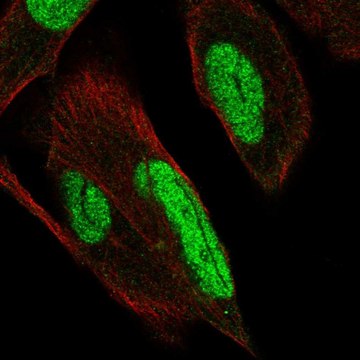 Anti-PKNOX1 antibody produced in rabbit Prestige Antibodies&#174; Powered by Atlas Antibodies, affinity isolated antibody