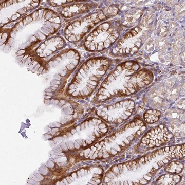 Anti-ATP6V1F antibody produced in rabbit Prestige Antibodies&#174; Powered by Atlas Antibodies, affinity isolated antibody, buffered aqueous glycerol solution