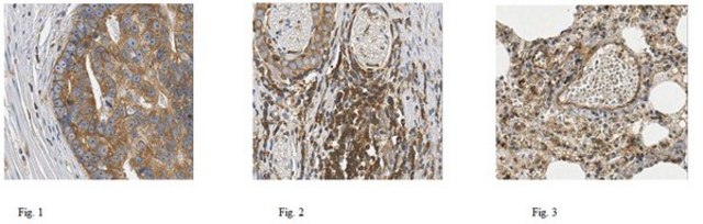 Anti-Talin 1 Antibody, clone TA205, N-Term, Ascites Free clone TA205, from mouse