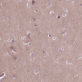 Anti-MAPT antibody produced in rabbit Prestige Antibodies® Powered by Atlas Antibodies, affinity isolated antibody, buffered aqueous glycerol solution