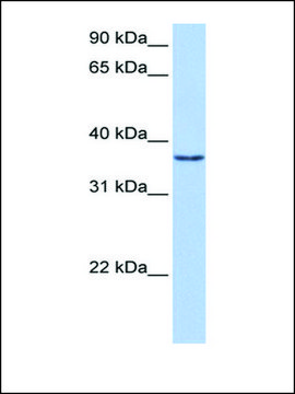 Anti-VGLL2 antibody produced in rabbit affinity isolated antibody