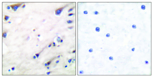 Anti-KSR antibody produced in rabbit affinity isolated antibody