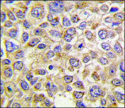 Anti-PMAT(Slc29a4) (N-term) antibody produced in rabbit IgG fraction of antiserum, buffered aqueous solution