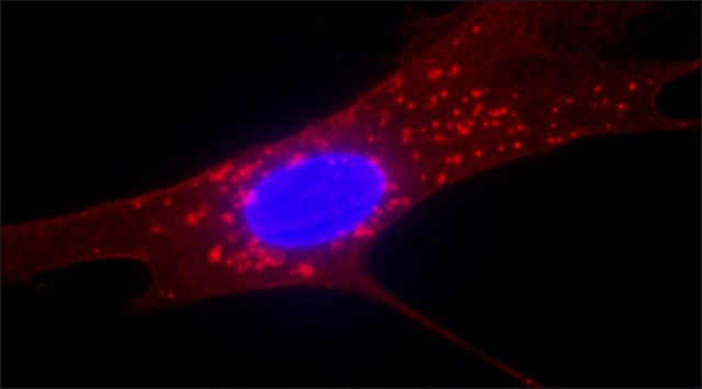 Anti-Fibroblast Surface Protein antibody, Mouse monoclonal clone 1B10, purified from hybridoma cell culture