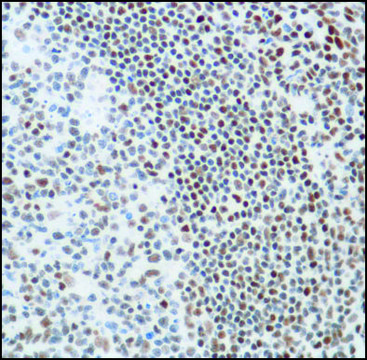 Anti-KU80 antibody, Rabbit monoclonal clone SP130, recombinant, expressed in proprietary host, affinity isolated antibody