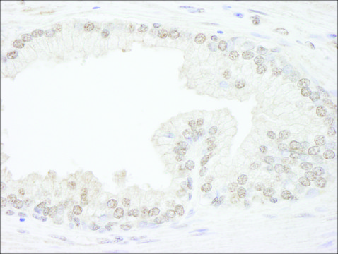 Rabbit anti-ATRX Antibody, Affinity Purified Powered by Bethyl Laboratories, Inc.